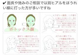 ボトックス顔