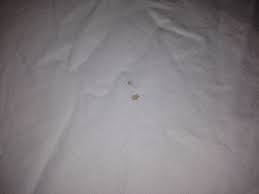 Looking for ways to remove blood from other surfaces and fabrics? Remove Blood Stains Even After Drying 3 Steps Instructables