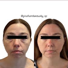 Still helping and taking care of humans, just looks a little different!  💉🪩✨ #viral #nursepractitioner #aesthetics #austinmedspa #austininjector  #fyp