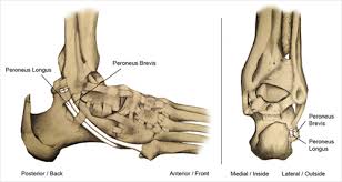 Ligaments connect one bone to another, while tendons connect muscle to bone. Peroneal Tendinosis Footcaremd