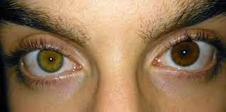 Why Are My Eyes Changing Color Laser Vision Eye Care Center