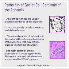 Pathology Of Goblet Cell Carcinoid Of The Appendix Educational Gif Medicine Notes Pathology Education