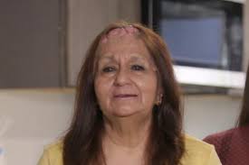 Dr. Pimple Popper's Top Pops: Before-and-After Photos