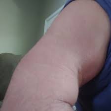 THE BONE & JOINT CLINIC