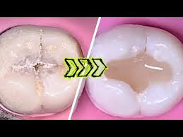 We did not find results for: Gigi Palsu Yang Ditanggung Bpjs Prakerja Bpjs