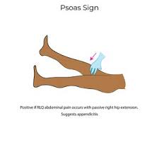 Image result for Obturator Sign