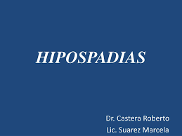 Hipospadias doğumsal (konjenital) bir kusurdur. Ppt Hipospadias Powerpoint Presentation Free Download Id 5643361