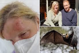 Image result for Bat Bite