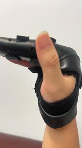 Image result for Radial Gutter Cast