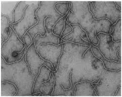 Image result for Grapevine leafroll virus