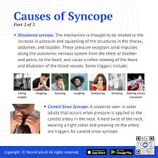 Image result for Exercise Induced Syncope