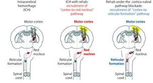 Якщо шукаєте книгу тоді вам до нас. Dynamic Reorganization Of Brain Circuit With Post Stroke Rehabilitation Eurekalert Science News