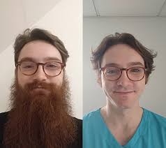 A junior doctor who has changed their facial hairstyle during the...