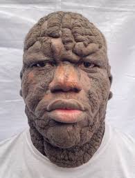 I have not had any contact with this bro since the day I travelled to Port  Harcourt & you raised millions for him to travel to a Hospital in Boston  for Treatment!