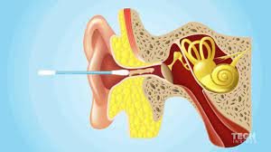 Why You Shouldn T Use A Q Tip To Clean Your Earwax Cleaning Your Ears Ear Wax Perfect Teeth