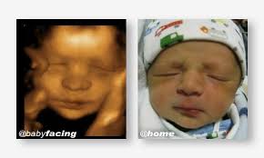 Holen sie sich ein 29.000 zweites pregnancy baby ultrasound 4d stockvideo mit 25fps. Baby 3d Ultraschall Studio Babyfacing De Beitrage Facebook
