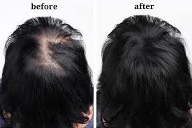 Using aloe vera gel is one among the easy and effective remedies that can help to. How To Increase Hair Density 13 Proven Ways To Increase Hair Growth Fast Luxury Beauty Club