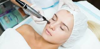 Microneedling Skin Treatment