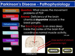Remarkable effectiveness of deep brain stimulation (dbs) for parkinson's disease (pd) has occupied the interest of many scientists and their efforts for elucidating its mechanism have given us a lot of clues for understanding of pathophysiology of pd. Parkinson S Disease Self Study Tutorial Ppt Download
