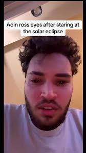 @adin eyes after staring at the sun #solareclipse #eclipse #adinross  #adinrosseye #fyp #viral #trending