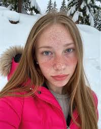 Most people make jokes about my skin. You too?