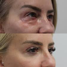 Another Dr Papanastasiou has just been added to the clan! Alexa, you've  made us very proud and you deserve a huge congratulations!! Now onto your  next chapter in your surgery residency in