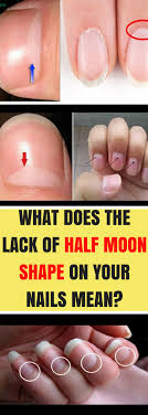 The Lunula Of Your Nails Or The White Half Moon As A Great Many People Know It Is A Delicate Piece Of Your Body You Nailed It Nail Health Moons On