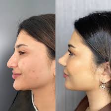 Arken Consultancy‎