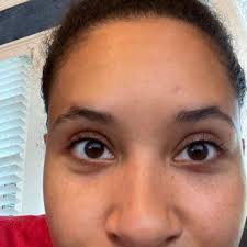 DERMATOLOGY CENTER OF ATLANTA