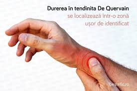 Recent, ați început să observați la amorțeală la nivelul extremităților? Durere In Mana Slabiciune Amorteli Furnicaturi Semnificatie Si Tratament