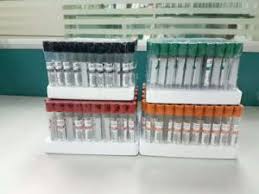 sst blood collection tube with color chart