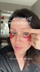 Update, Queens 🚨, We’re officially 4 weeks post-first laser sesh to zap  out that old red brow pigment. The red is gone, but the pigment is still  here… but it’s definitely faded! , I’ll probably need ...