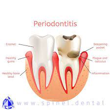 Pin On Dental Knowledge