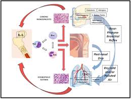 Pediatric Rhinosinusitis And Asthma Respiratory Medicine