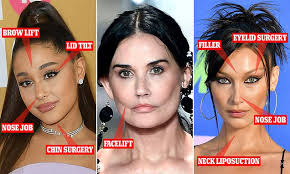Rhinoplasty surgery, before and after. Plastic Surgeon Reveals Which A Listers Have Most Likely Gone Under The Knife Daily Mail Online