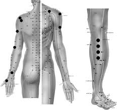 Location Location Location Acupuncture And Chronic Shoulder