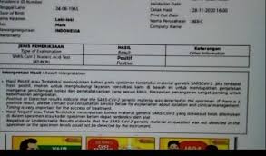 If your test was done at a dha facility, you can get your report via the dha app. Viral Dokumen Hasil Swab Test Rizieq Shihab Positif Covid 19 Ini Kata Mer C