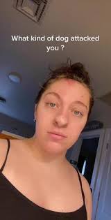 Remember If Your Dog Attacks My Trend