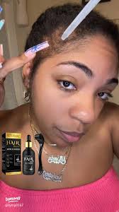 Minoxidil for Hair Growth: Effective Solutions and Tips