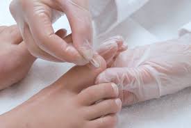 Ich habe dort ziemliche himmelfahrtsnägel, von denen vorne hin und wieder ein stück abblättert (dann sind sie statt 4 mm² nur noch 2 mm² groß ). Behandlung Mit Podofix 3to Ihr Spezialist Fur Nagelspangen