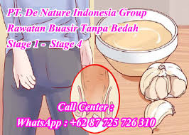 Sebab menurut riset lantas seperti apa cara merawat mesin mobil yang harus anda lakukan? Storymapjs Review Ubat Mengecutkan Buasir Luaran Selamat