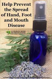 Hand Foot And Mouth Disease Spot It Avoid It Treat It Hand Foot And Mouth Essential Oils Hand Foot Mouth Hand And Mouth Disease