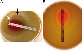 Image result for Penicillin Resistant Pneumococcus