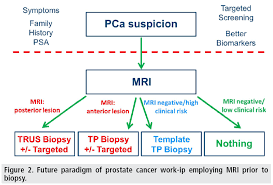 Mri is valuable in diagnosing many conditions … What Is Multiparametric Mri Of The Prostate And Why Do We Need It