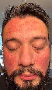 World Carnivore Tribe