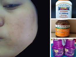 Blackmores vitamin c 500 maintains vitamin c levels in the body and contains no added artificial flavours or sweeteners. Tak Miss Ambil Setiap Hari Wanita Kongsi 15 Kebaikan Vitamin C Jadikan Kulit Flawless Sihat Maskulin