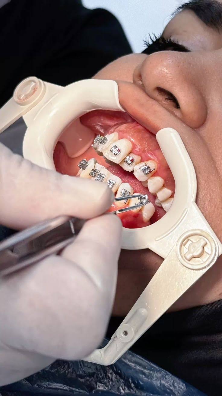 Orthodontic Treatment product image