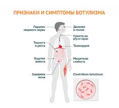 Myshechnaya Slabost