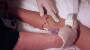 Image result for Blood Doping