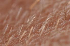 Vellus Hair Wikipedia